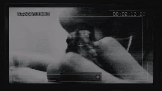E1.Surveillance